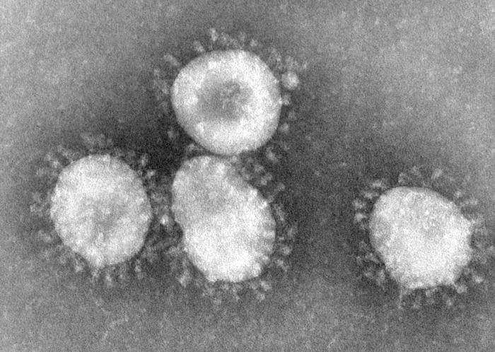 Coronaviruses. מתוך ויקיפדיה
