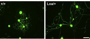 في الخلايا العصبية الطافرة (على اليمين)، حيث يتم تقليل كمية الداينين، تنمو الامتدادات إلى طول أكبر مما هي عليه في الخلايا العصبية الطبيعية (على اليسار).