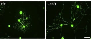 In mutant nerve cells (right), in which the amount of dynein is reduced, the extensions grow to a greater length than in the normal nerve cells (left)