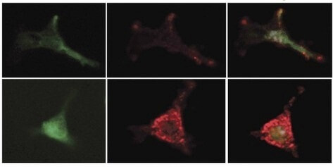 تحافظ البروستاجلاندين على الخلايا الجذعية شابة عن طريق زيادة التعبير عن المادة المثبطة من الخلايا الوسيطة في نخاع العظم. البروتين الملون باللون الأخضر (يسار) هو علامة للخلايا الوسيطة. المانع ملون باللون الأحمر (الوسط). على اليمين: التلوين المشترك للمادتين. يمكن ملاحظة أن العلاج بالبروستاجلاندين (الصف السفلي) يزيد من التعبير عن المادة المثبطة. رسم توضيحي: البروفيسور تسفي لابيدوت، معهد وايزمان