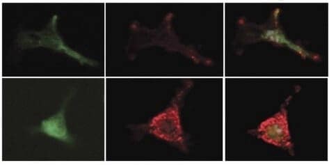 Prostaglandins keep the stem cells young by increasing the expression of an inhibitory substance from mesenchymal cells in the bone marrow. The protein colored green (left) is a marker for mesenchymal cells. The inhibitor is colored red (center). Right: combined coloring of the two materials. It can be seen that treatment with prostaglandins (bottom row) increases the expression of the inhibitory substance. Illustration: Prof. Zvi Lapidot, Weizmann Institute