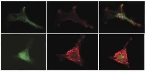 פרוסטגלנדינים שומרים על תאי הגזע צעירים באמצעות הגברת הביטוי של חומר מעכב מתאים מזנכימליים בלשד העצם. החלבון הצבוע בירוק (משמאל) הוא סמן לתאים מזנכימליים. החומר המעכב צבוע באדום (במרכז). מימין: צביעה משולבת של שני החומרים. ניתן לראות כי טיפול בפרוסטגלנדינים (בשורה התחתונה) מגביר את ביטוי החומר המעכב. איור: פרופ' צבי לפידות, מכון ויצמן