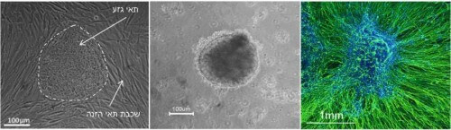 Image 2: Differentiation process of stem cells into nerve cells. The source of the photo: Sharon*. Human embryonic stem cells grown in cell culture on fibroblasts of human origin. The stem cells are grown on a layer of cells that are used as a feeder layer (on the "feeder layer" left picture). In order to make them differentiate, they are collected and grown as a cluster of cells in suspension (central image), and various substances are added to them that cause them to differentiate into neurons (right image, after 10 weeks of sorting - dyed with a special fluorescent dye green - nerve cells. Blue - the cell nuclei).