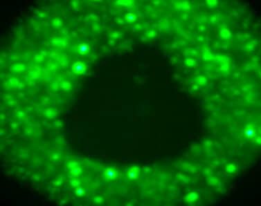 Cancer cells are infected with the virus (glowing green) around dead cells in the center of the tumor, where there is a lack of oxygen. Photo courtesy of the journal Cancer Research