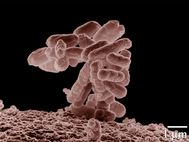 תמונה 1: חיידקי אי-קולי בהגדלה פי 10,000. המקור לתמונה: Agricultural Research Service, דרך ויקיפדיה.
