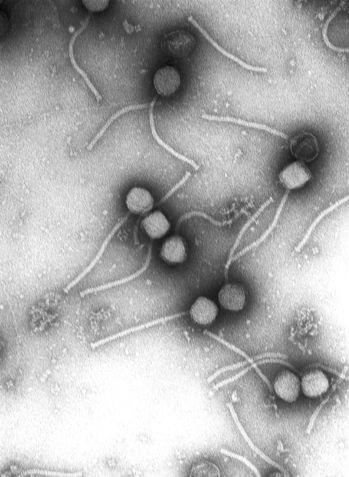 Bacteriophages. Credit: Wikimedia Commons/PLoS One/Vincent Fischetti and Raymond Schuch, The Rockefeller University