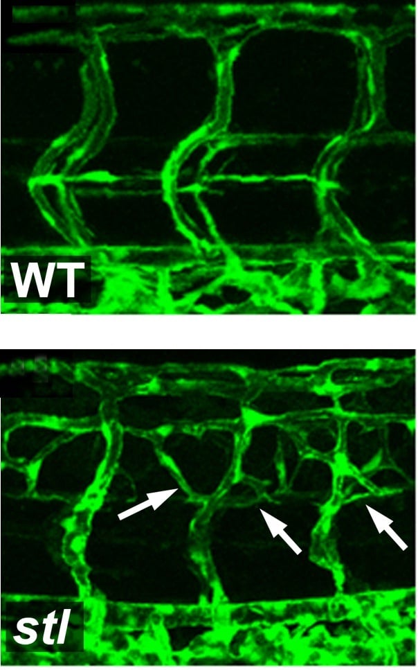 Photomicrograph of blood vessels in zebrafish embryos. In the fish containing the mutation (in the bottom picture) there is an increased growth of blood vessels, compared to a normal fish embryo (in the top picture)