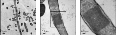 המחסור ב-ATP בתאים של אשריכיה קולי גורם להם לקבל צורה מוארכת וליצור מבני ליפידים דחוסים הקרויים אנדוליפוזומים. את המבנים הללו ניתן לראות בברור בתמונות המובאות כאן שהתקבלו בעזרת מיקרוסקופ מסוג TEM.