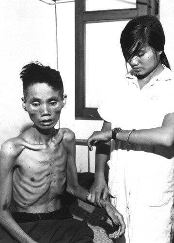 The effect of one month of starvation in the Viet Cong POW camps.