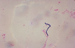 חיידק המעיים המפורסם סטרפטוקוקוס. מתוך ויקיפדיה