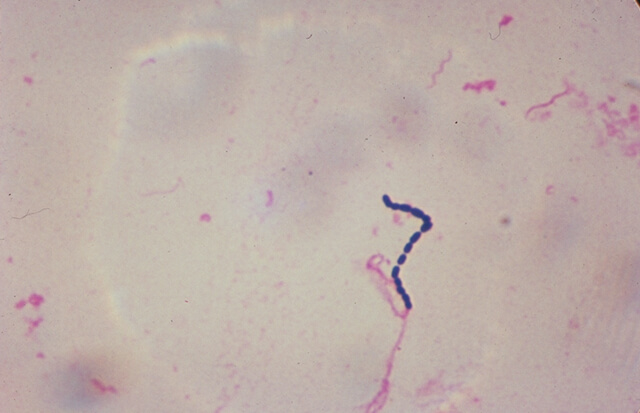The famous intestinal bacteria Streptococcus. From Wikipedia