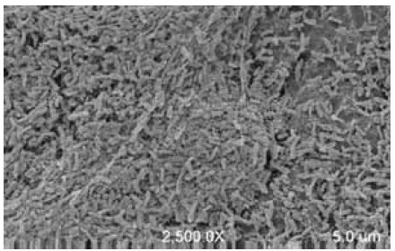 Electron microscope image: Pseudomonas aeruginosa biofilm developed on a catheter