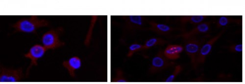 Polyploid stem cells under a fluorescence microscope at two stages of cell division. On the left: the centrosomes (red dots), bodies that help the DNA (in blue) split into two during cell division, begin to shrink into clusters on both sides of the nucleus. Hydrogen: The centrosomes are contracted in two clusters (large red dots), which allows the DNA (in blue) to be divided equally between the two daughter cells. As a result, the cell divides properly, and does not become cancerous