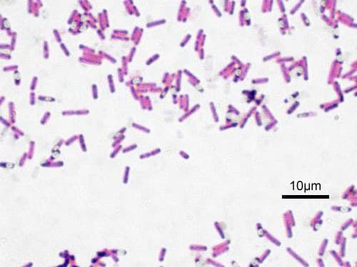תמונה 2: Bacillus subtilis צבוע תחת מיקרוסקופ. המקור לתמונה: ויקיפדיה.