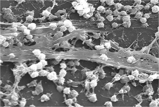 Image 1: Biofilm of the bacterium Staphylococcus aureus. Image source: Wikipedia, source CDC source