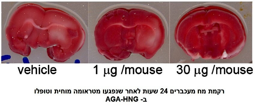 מוחות עכברים. צילום: ב.ג. נגב ואוניברסיטת בן גוריון