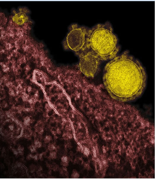 The MERS virus. Figure Credit: NIAID/RML