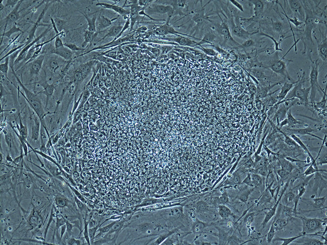 תאי גזע במבחנה לאחר שיבוט עובר אנושי הנושא מטען גנטי של חולה ספציפי באוניברסיטה הרפואית-מדעית של אורגון. צילום: UHSO
