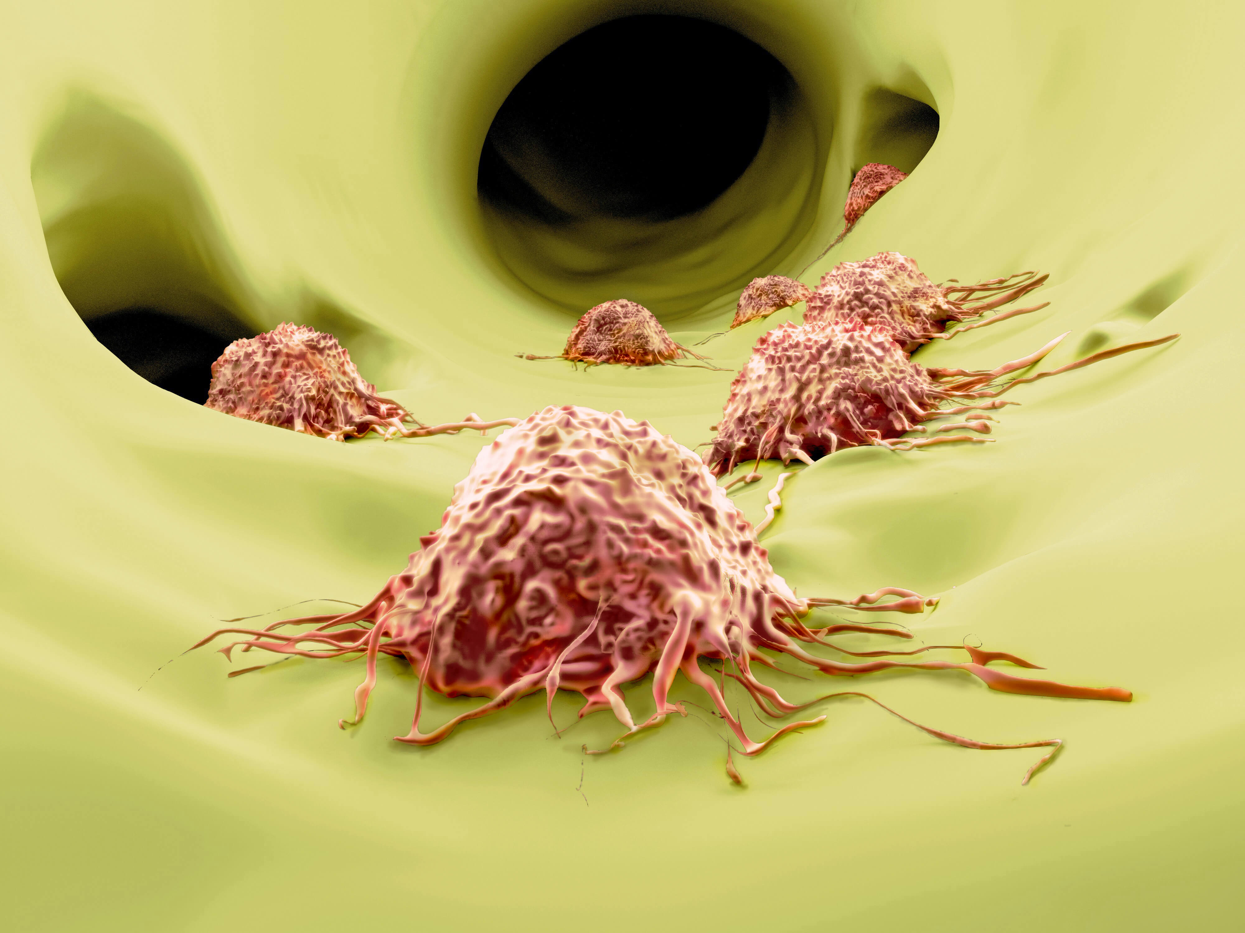 Cancer cells migrate through the body. Photo: shutterstock