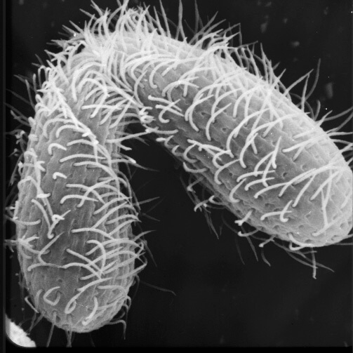 תמונת מיקרוסקופ אלקטרונים סורק של זוג טֶטְרָהִימֶנָה במהלך הזדווגות. צילום: The SEPA ASSET (Advancing Secondary Science Education with Tetrahymena) program at Cornell University