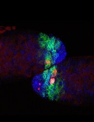 Confocal microscope observation of two mature fruit fly testes filled with dividing germ cells (in green). About a quarter of these cells (in red and pink) die in the alternative death pathway