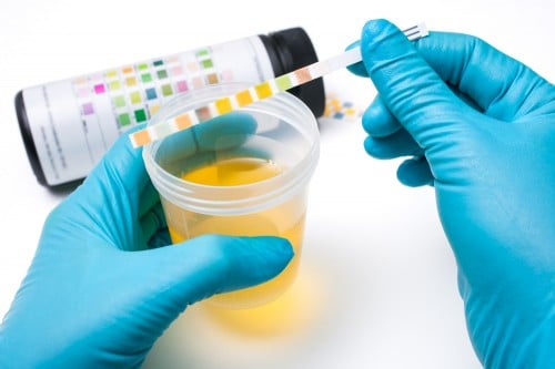 Urine Test. Illustration: shutterstock