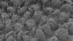 אוכלוסיות חד-תאיים במעי. תצלום מיקרוסקופ אלקטרונים סורק של אוכלוסיות חד-תאיים על גבי תאי האפיתל במעי