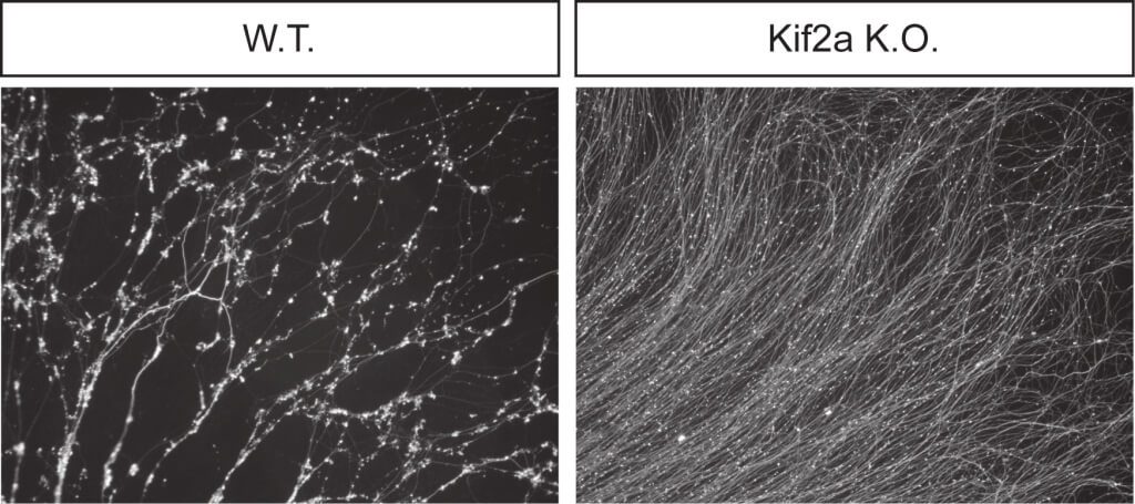 תאי עצב רגילים (משמאל) עוברים גיזום, ואילו בתאי עצב בהם הגן KIF2A פגום תהליך הגיזום אינו יוצא לפועל
