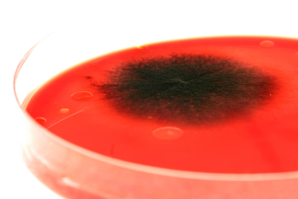 A colony of antibiotic-resistant bacteria on a human blood sample. Photo: shutterstock