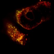 תאי גזע מושרים אנושיים נייטראליים לחלוטין, שיוצרו בשיטתו של ד"ר חנא (בירוק וצהוב), משתלבים ברקמות שונות של עובר עכבר (באדום) וידאו: סרטון המציג את השתלבותם של תאי גזע מושרים אנושיים נייטראליים, שיוצרו בשיטתו של ד"ר חנא (בירוק וצהוב) ברקמות של עובר עכבר (באדום). צילום: ד"ר יעקוב חנא, מכון ויצמן
