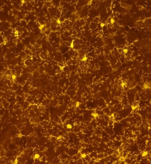 Image of microglial cells in a genetically modified mouse brain, developed by Prof. Jung's group. Photo: Weizmann Institute