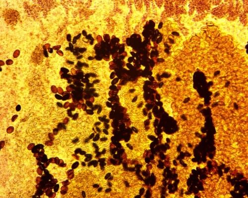 خلايا الكبد عند التكبير العالي. الصورة: شترستوك