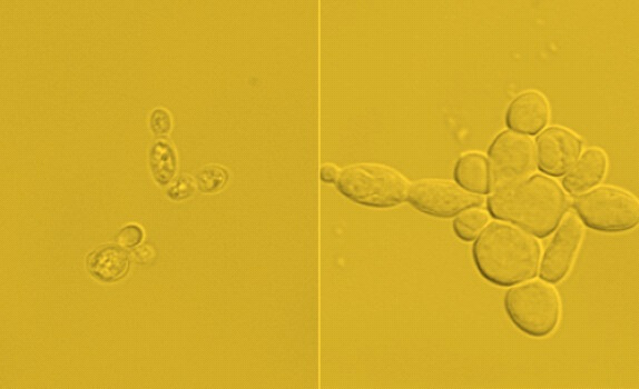 משמאל: התאים ההתחלתיים בעלי תכולה של 15% ליפידים. מימין: תאים מהונדסים בעלי תכולה של כמעט 90% ליפידים. [באדיבות: University of Texas at Austin]