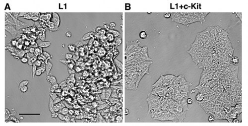 Without the c-Kit gene, colon cells behave wildly and invasively (left), but when c-Kit is expressed properly, the cells return to their orderly behavior (right)