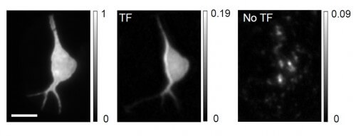 תאי עצב תחת מיקרוסקופ דו-פוטוני. משמאל: שימוש בקרן לייזר ממוקדת. במרכז: שימוש בשיטת המיקוד בזמן. מימין: ללא מיקוד בזמן