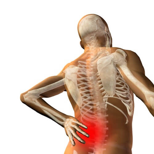 back pain. Illustration: shutterstock