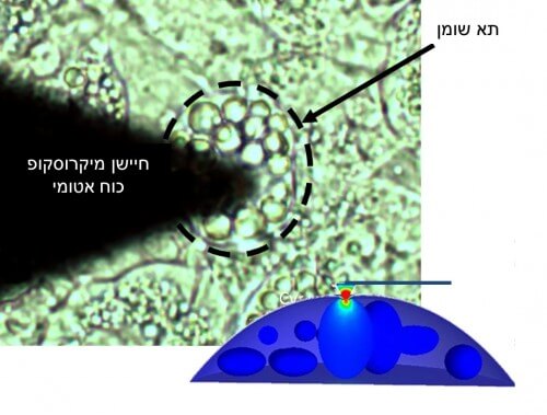 לחץ על תאי השומן מוביל להשמנה. איור: : פרופ' עמית גפן , אוניברסיטת תל אביב