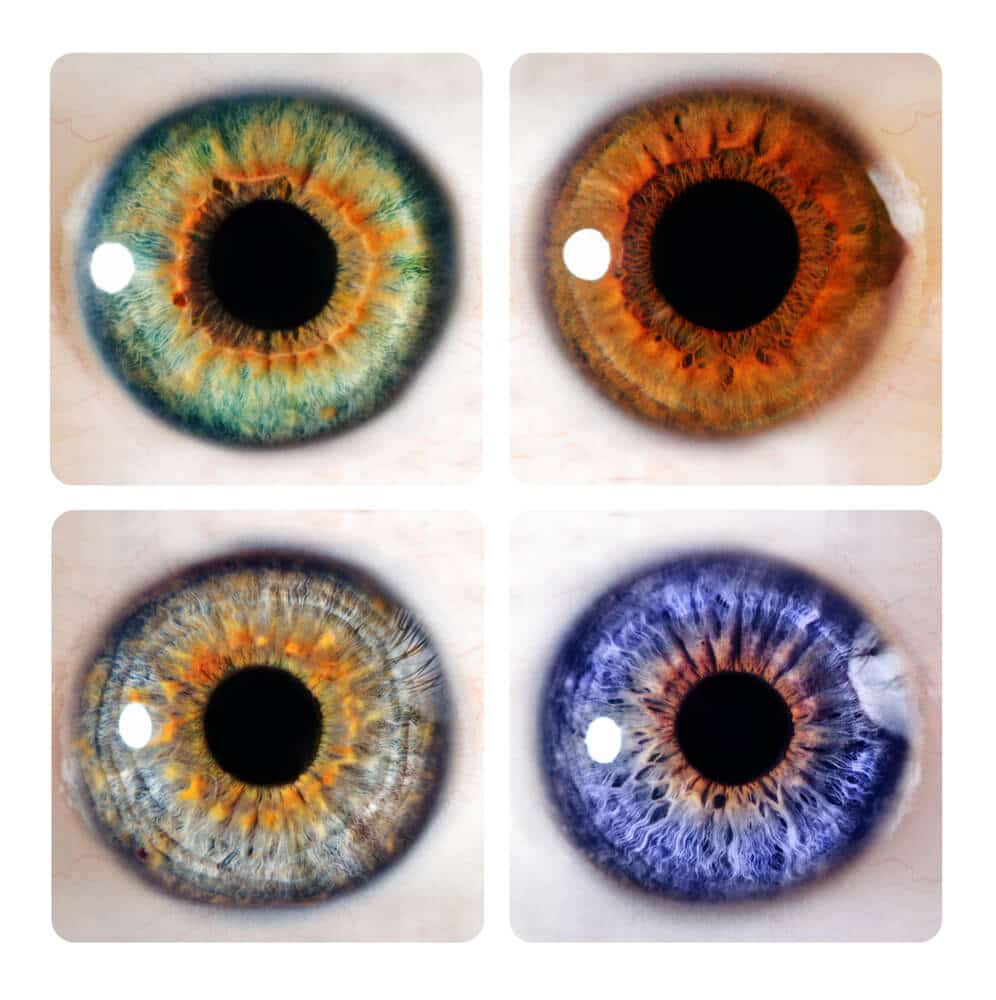 An example of the effectiveness of the treatment on people with different eye colors. Photo: Davidson Institute for Science Education.