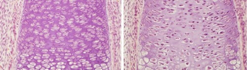 Cartilage cells in the developing bone (left). When the expression of the HIF-1α gene is damaged, the number of cells in the low-oxygen area decreases, and their supporting tissue shrinks (right)