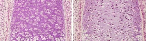 Cartilage cells in the developing bone (left). When the expression of the HIF-1α gene is damaged, the number of cells in the low-oxygen area decreases, and their supporting tissue shrinks (right)