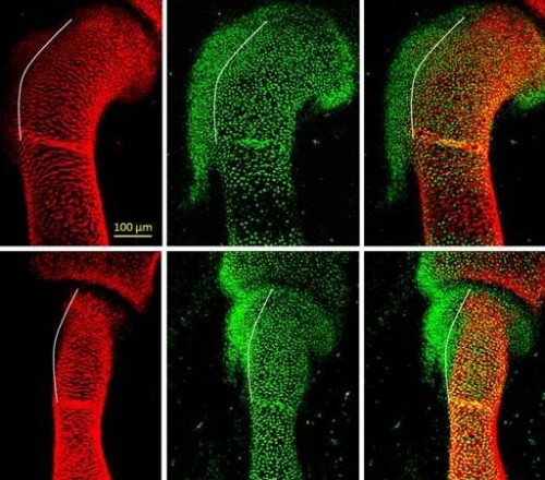 Bone develops in a normal (top) and mutant (bottom) embryo. Bumps in a developing bone are formed from a group of cells (green) that is different from the familiar bone-building cells (yellow-orange). Disruptions in the control mechanisms and distribution of these cells lead to distortions in the shape of the developing bone