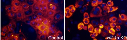 Cartilage cells secrete collagen (red) in a low-oxygen environment, under a fluorescence microscope (left). When the HIF-1α gene is damaged the collagen is not secreted properly (right)