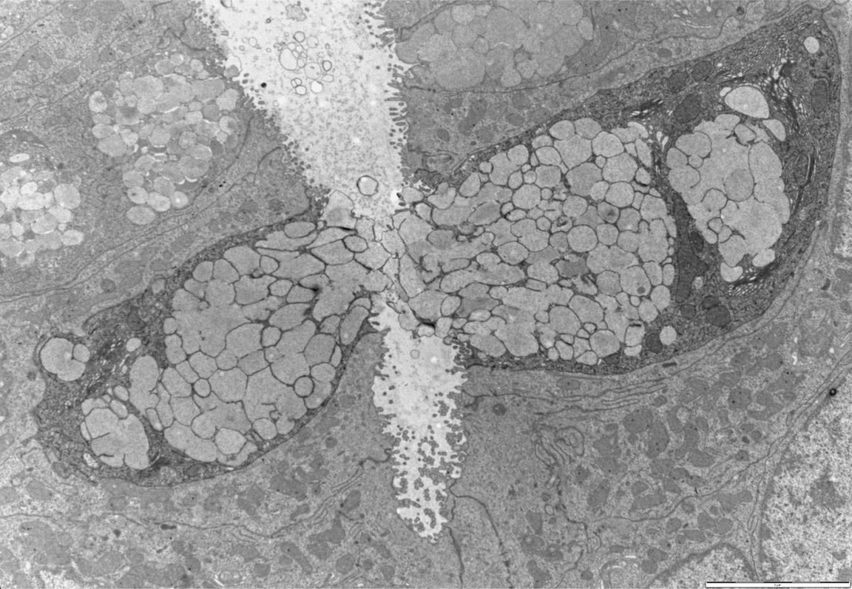 צילום מכיוון חלל המעי אל פני השטח שלהם באמצעות מיקרוסקופ אלקטרונים סורק. ניתן לראות קבוצות של בועיות בולטות מפני השטח של תאי הגביע, בדרכן להשתחרר אל תוך חלל המעי. בעכבר נטול אינפלמזום הבועיות בולטות אך אינן מופרשות