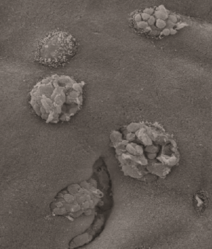 צילום במיקרוסקופ אלקטרונים חודר: שני תאי גביע המפרישים את תוכנם לתוך חלל המעי