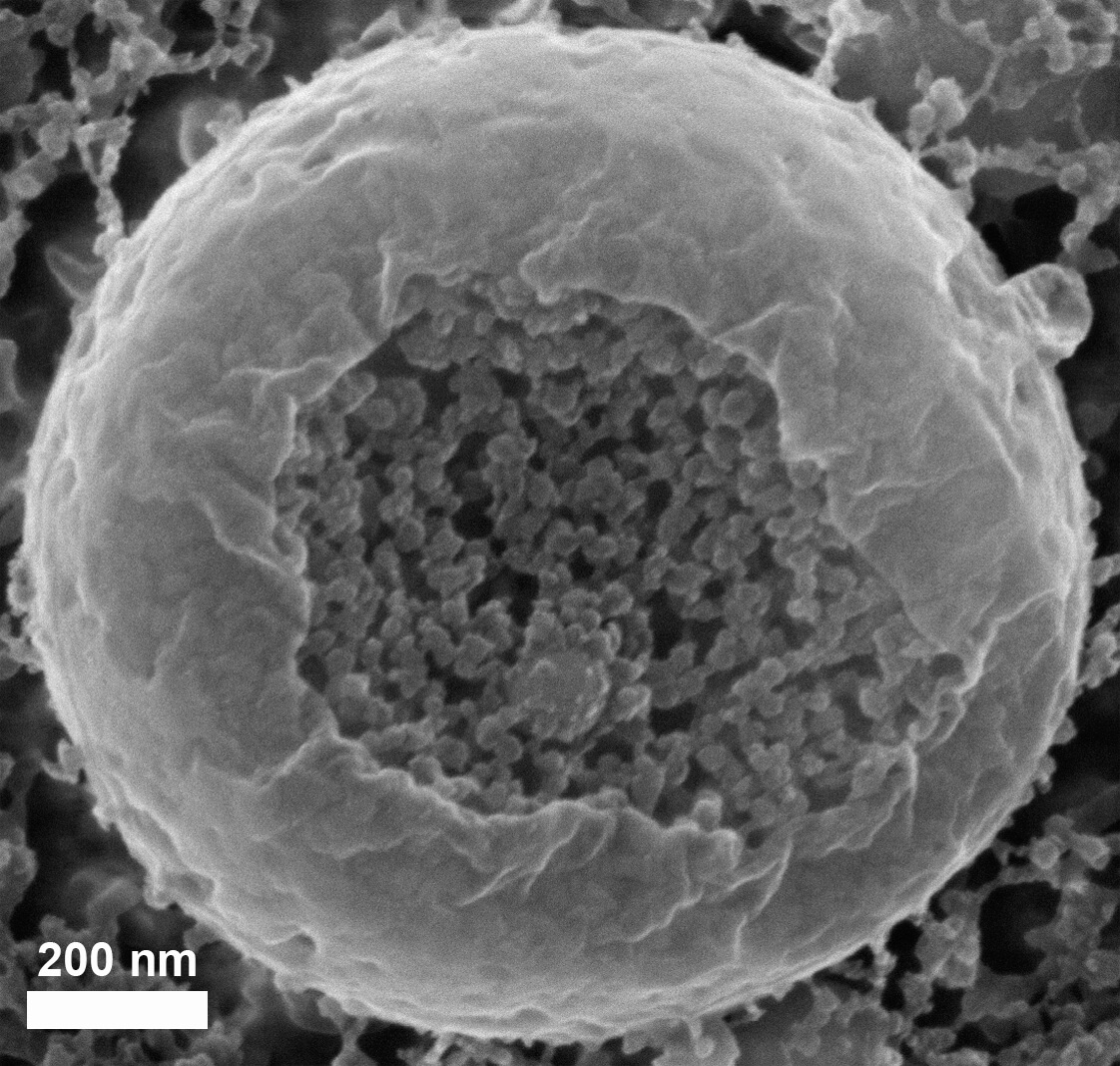 צילום במיקרוסקופ אלקטרונים סורק: שלפוחית המכילה ננו-כדוריות של סידן פחמתי, שגודלן 20 עד 30 ננו-מטרים, בדגימת עובר קיפוד ים קפואה