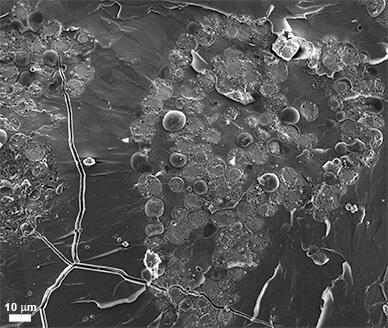  צילום במיקרוסקופ אלקטרונים סורק: עובר קיפוד ים מוקפא המכיל מספר גדול של שלפוחיות תוך-תאיות