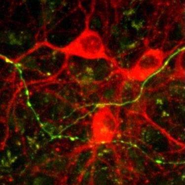 في الصورة ترى خلايا الدماغ تنمو في المزرعة بالإضافة إلى امتدادات الخلايا التي تشكل اتصالا معقدا فيما بينها.