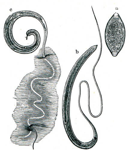 A whip-like parasitic worm. Illustration: shutterstock