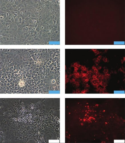 Mesenchymal stem cells grown at different densities. Left: photo with a light microscope. Right: staining with antibodies for markers of endothelial or epithelial cells. Top row: densely seeded cells have an uneven shape, and they do not express endothelial or epithelial cell markers. In the center: cells derived from thin cultures develop a cubic structure typical of epithelial cells, and express the markers of these cells. Bottom row: cells seeded at a distance take on an elongated shape and express markers of endothelial cells