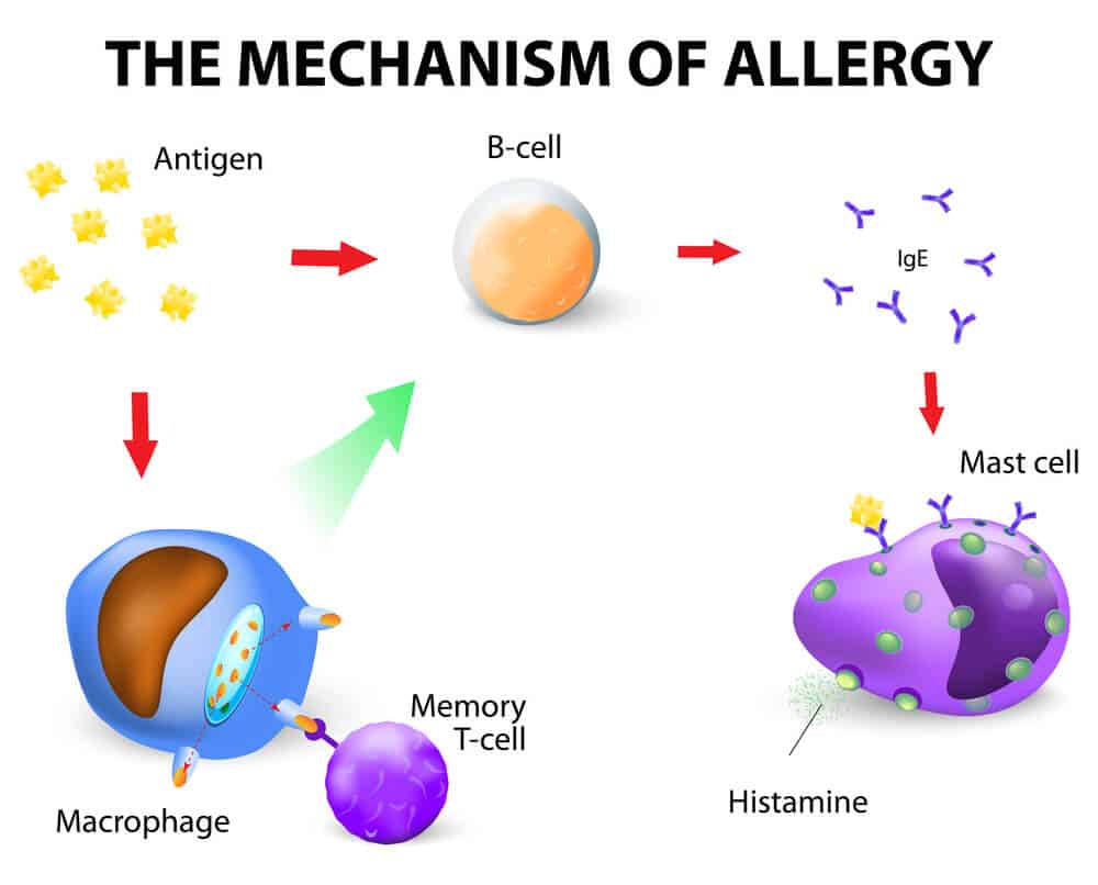 The mechanism in the immune system that causes allergy symptoms. Illustration: shutterstock